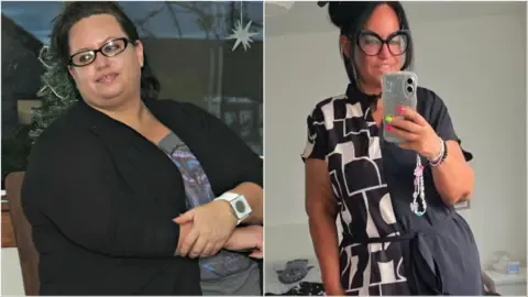 Many Shed Weight With Injections – Then Came the Sagging Skin